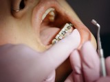 Kje in kako dobiti ortodonta na napotnico?